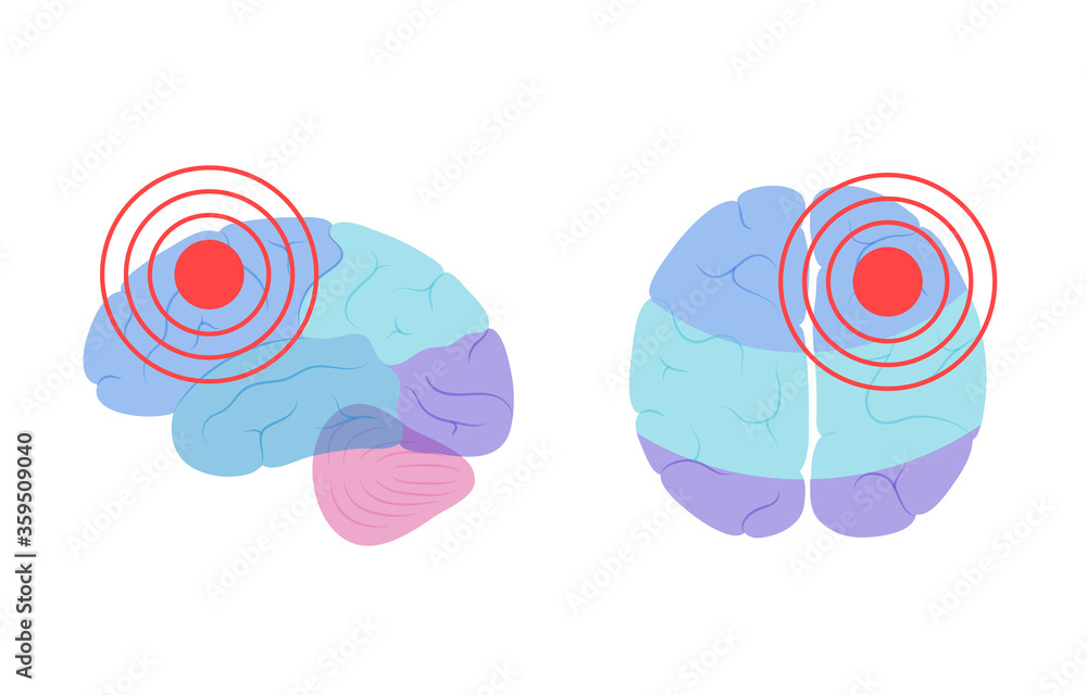 Canvas Prints Pain Brain Illustration