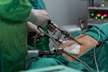 The surgeon holding the instrument in abdomen of patient. Minimally invasive surgery.