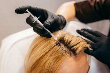 Young blonde woman with hair loss problem receiving injection, close up
