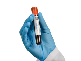 Naklejka premium COVID-19 or Coronavirus Blood Test 