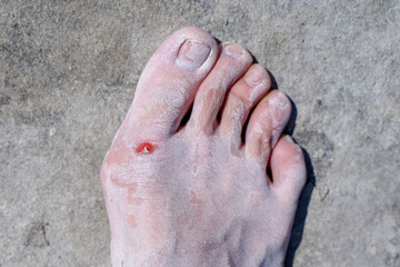 Bare feet of men in the pink salt lake. Salt Deposit. Treatment of wounds with salt. Healing...