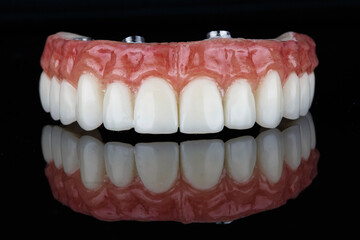 Dental prosthesis of the upper jaw, shot on black glass with reflection