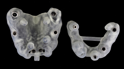 surgical dental templates for the lower and upper jaws made of polymer, top view on a black background © Dental Pro Content