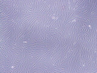 Fibroblasts ,the most common cells of connective tissue in animals, were captured by Light Microscope (40x)