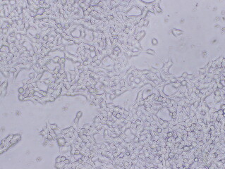 Human Embryonic Kidney Cells 293 (HEK-293 Cells) were captured by Light Microscope (100x)