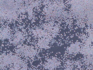 Mouse Macrophage Cells (TIB-67 Cells) were captured by Light Microscope (40x).