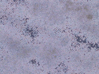 Mouse Macrophage Cells (TIB-67 Cells) were captured by Light Microscope (40x).