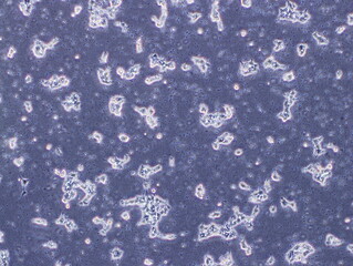 Human Brain Endothelial Cells (hCMEC/D3 cells) were captured by Light Microscope (40x)