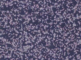 Human Colorectal Adenocarcinoma Cells (HT29 Cells) were captured by Light Microscope (40x)