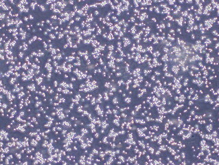Human Colorectal Adenocarcinoma Cells (HT29 Cells) were captured by Light Microscope (40x)