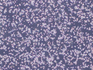 Human Colorectal Adenocarcinoma Cells (HT29 Cells) were captured by Light Microscope (40x)