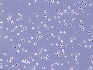 Human Keratinocyte Immortal Cells (HaCaT cells) were captured by Light Microscope (40x)