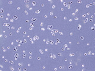 Human Keratinocyte Immortal Cells (HaCaT cells) were captured by Light Microscope (40x)