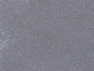 Mouse Macrophage Cells (TIB-67 Cells) were captured by Light Microscope (100x).