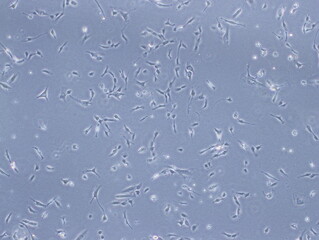 Human Brain Endothelial Cells (hCMEC/D3 cells) were captured by Light Microscope (40x)