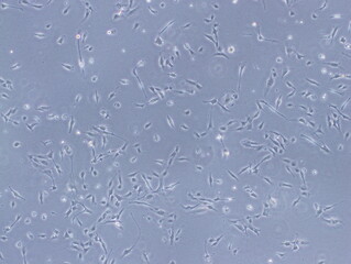 Human Brain Endothelial Cells (hCMEC/D3 cells) were captured by Light Microscope (40x)