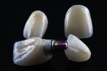 dental crown made of zircon high strength on a black background