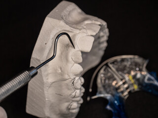 Crooked front tooth in upper children jaw. Dental gypsum models and dental brace. © rdonar
