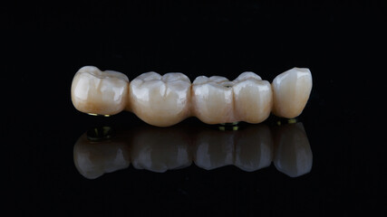 dental photo of a zircon bridge on a black background