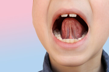 boy, kid performs articulation exercises for mouth, concept of speech disorders, correction, frenum...