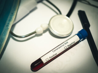 Concept of coronavirus blood test, Top view desk in laboratory and blood test tubes, stethoscope and respiratory mask. covid-19 or coronavirus biochemical analysis.