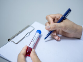 Concept of coronavirus blood test, Top view desk and hand of medical in laboratory and blood test tubes.