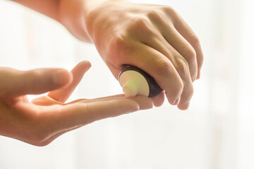 The hands of a teenager squeeze out a cream to care for problem skin.