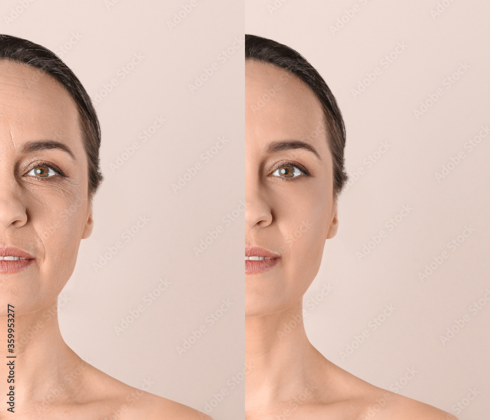 Poster mature woman before and after cosmetic procedure on beige background