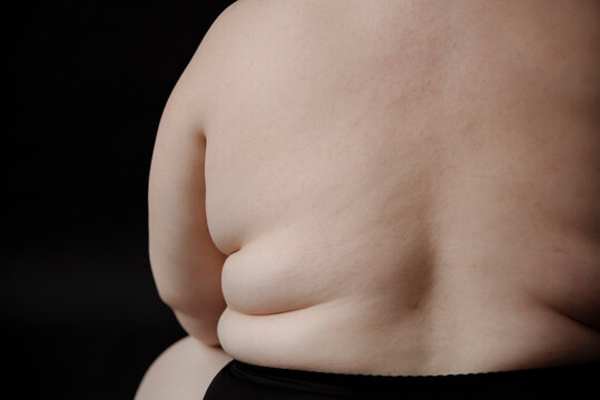Close up of folds of fat on female skin.