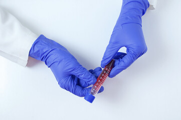 Hands in protective gloves with a test tube close-up of blood tests in hands on white background.