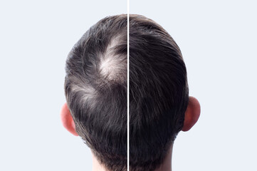 How To Thicken Thin Hair For Men