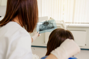 Young woman dentist explaining to her patient on a dental x-ray panoramic radiography all the dental treatment that needs to do in dentistry