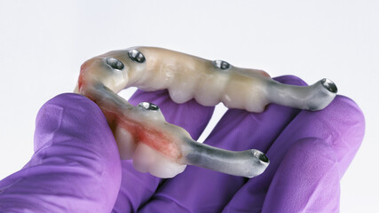 dental prosthesis for the upper jaw in the hands of a dental doctor with a glove, shot on a white background