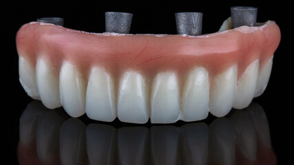 temporary dental prosthesis of the lower jaw for loading after implantation, shot on a black background with reflection