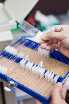 Scientist holding microscope slide over container at laboratory