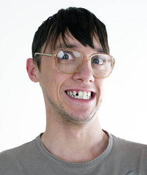 Close up portrait of Caucasian young man with greasy long black hair, big dark eyes, old glasses in t-shirt stupid smiling, show broken teeth, looking directly at camera isolated on white background.