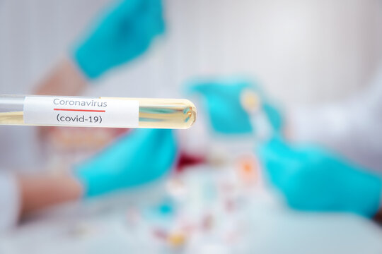 Test Tubes Containing Plasma Extracted From The Blood Of People Who Had Been Ill With Coronavirus, COVID-19. For Use In Making Medicines Or Vaccines.