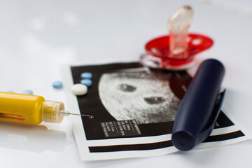 Ultrasonogram picture, syringe with a thin needle and some pills.