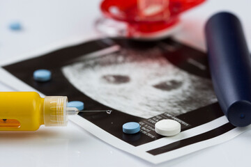 Ultrasonogram picture, syringe with a thin needle and some pills.