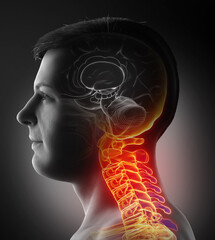 3d rendered, medically accurate illustration of male   having a painful neck