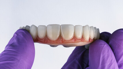 composition of the dental prosthesis of the upper jaw on a white background