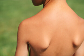 Child back tanned on nature, close up. Skin care. Healthy lifestyle. Kid on the nature on sunny day.