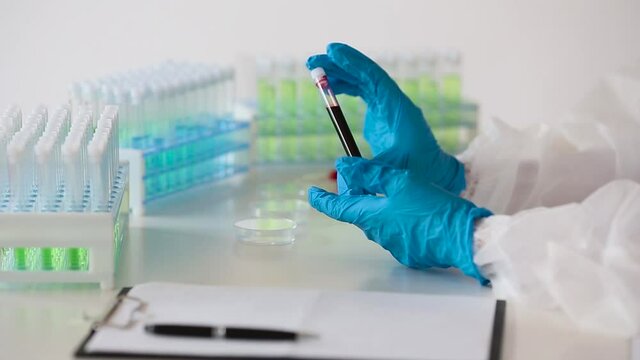 The doctor in the laboratory holds a test tube with a sample of infected blood. Close-up view.