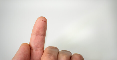Obraz premium Closeup of index finger flesh wound
