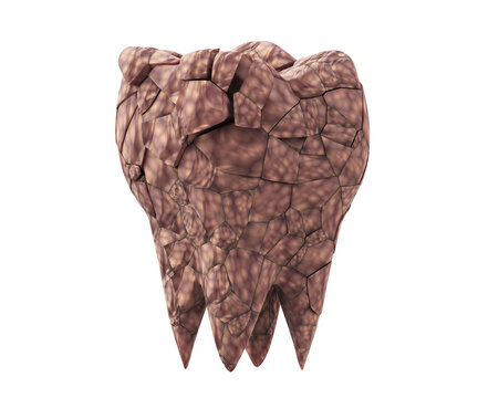 dirty plaque broken molar tooth isolated on white background. 3d illustration