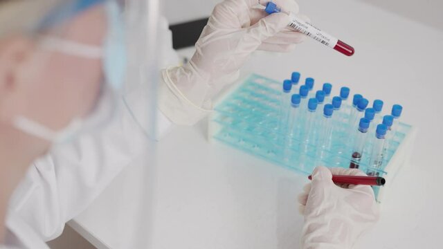 Coronavirus COVID-19 Positive concept Closeup of microbiologist or medical worker hand with surgical gloves marking blood test result as positive for the new rapidly spreading 