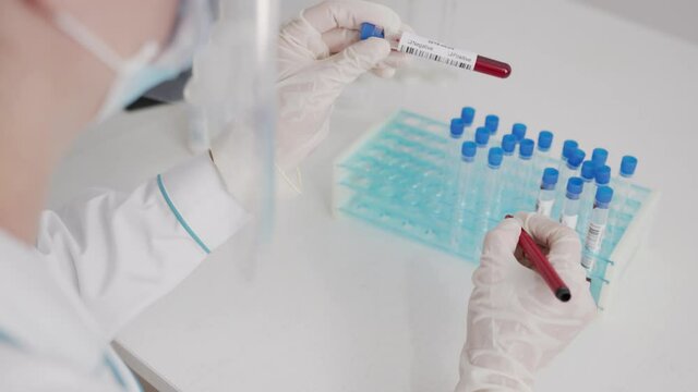 Coronavirus COVID-19 Negative concept Closeup of microbiologist or medical worker hand with surgical gloves marking blood test result as negative for the new rapidly spreading 