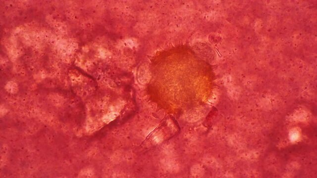 A pathogenic virus cell in the blood under a close-up microscope. Theme of viral diseases and detection of harmful cells. Concept of pathogens in microscopic world. Pollen of Tussilago plant shot.