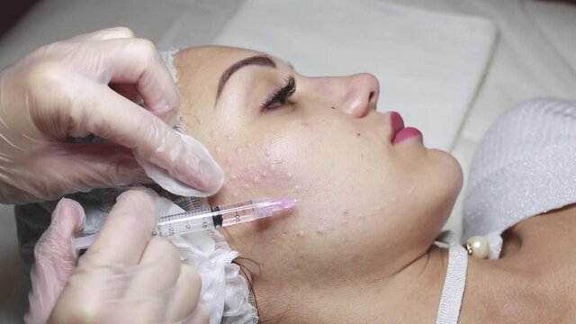 Face mesotherapy procedure in a beauty salon. Beautician doctor makes injections into the skin of the face of a young beautiful woman.Mesotherapy, biorevitalization.Close-up. Selective focus.