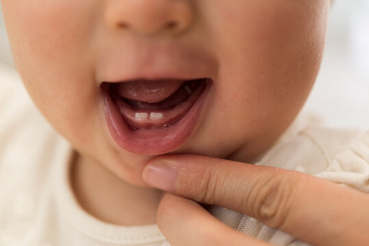 8ヶ月の赤ちゃんの歯